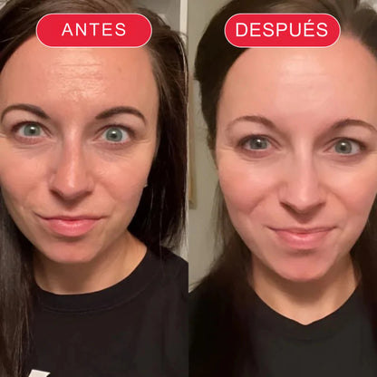 Koriderm+™ Crema Antiedad Rejuvenecedora