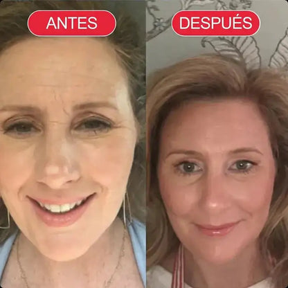 Koriderm+™ Crema Antiedad Rejuvenecedora