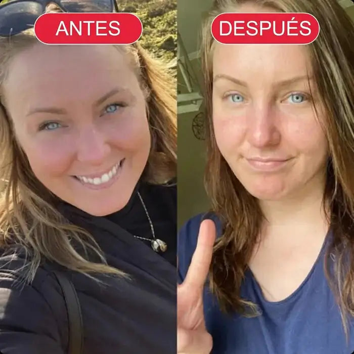 Koriderm+™ Crema Antiedad Rejuvenecedora