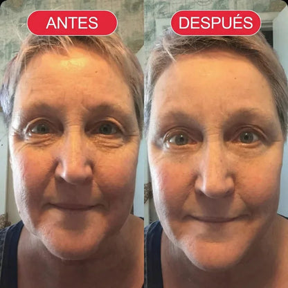 Para una piel que ha perdido firmeza, elasticidad y suavidad.