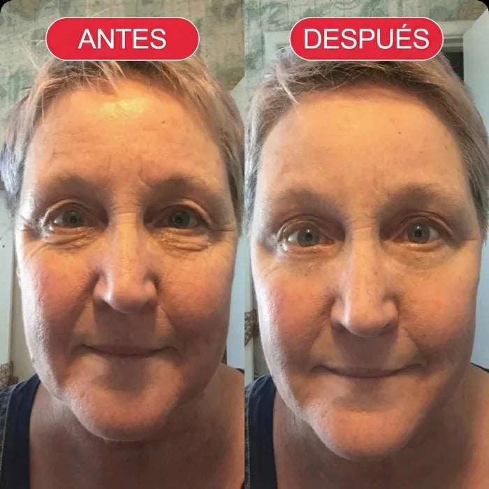 Koriderm+™ Crema Antiedad Rejuvenecedora