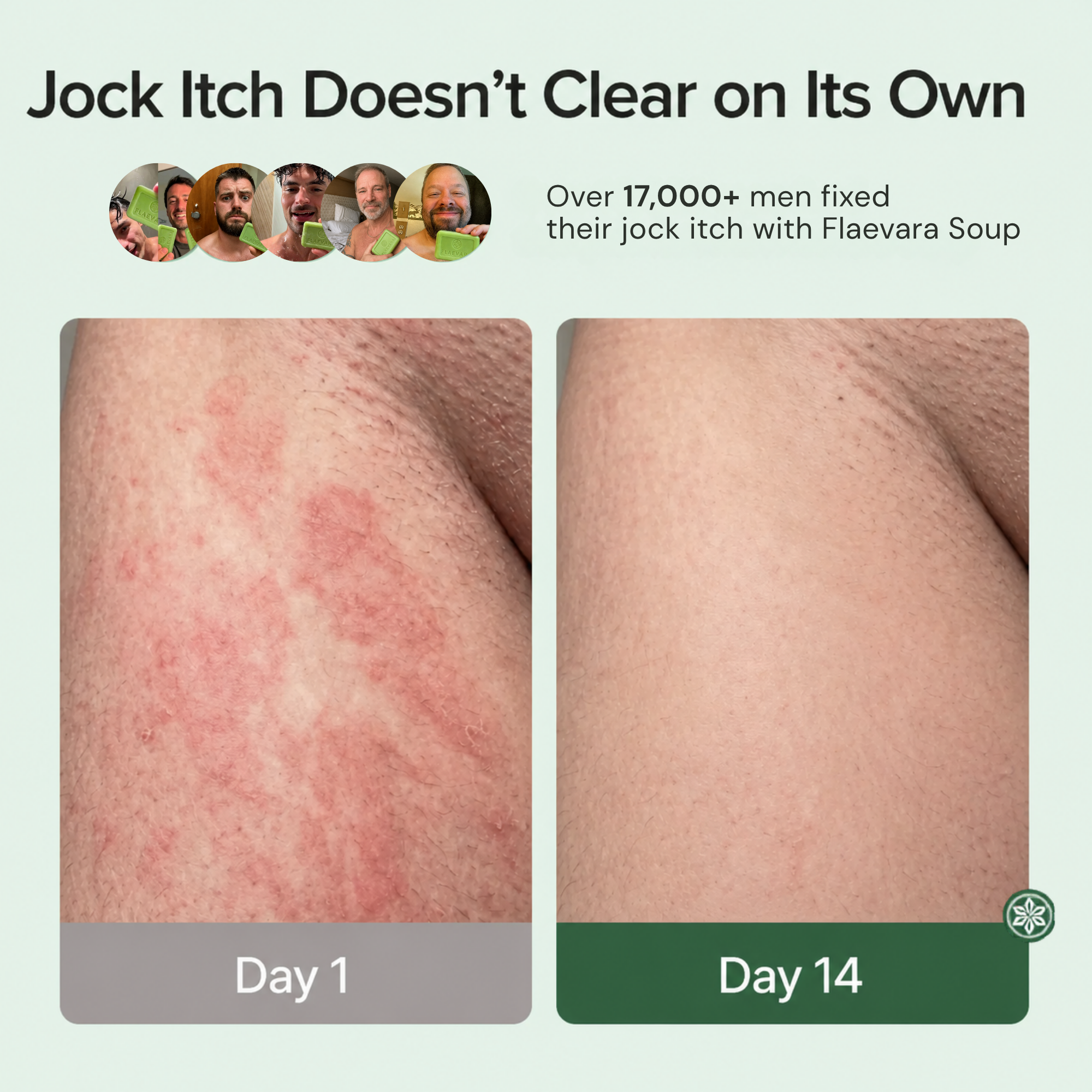 Flaevara™ Tea Tree Antifungal Soap