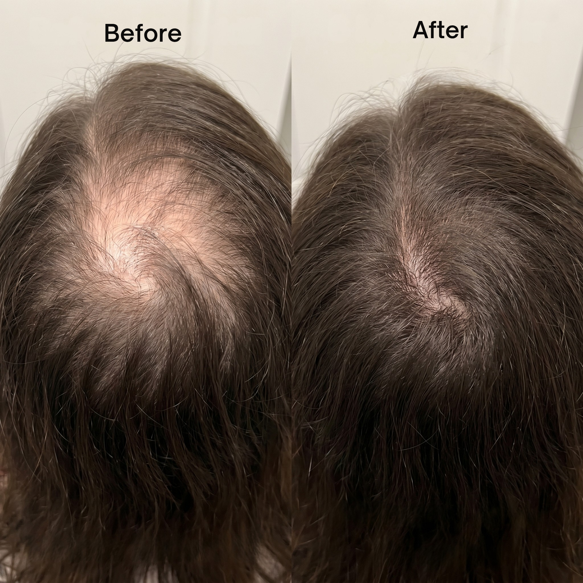 Flaevara™ Advanced Peptide Hair Growth Serum