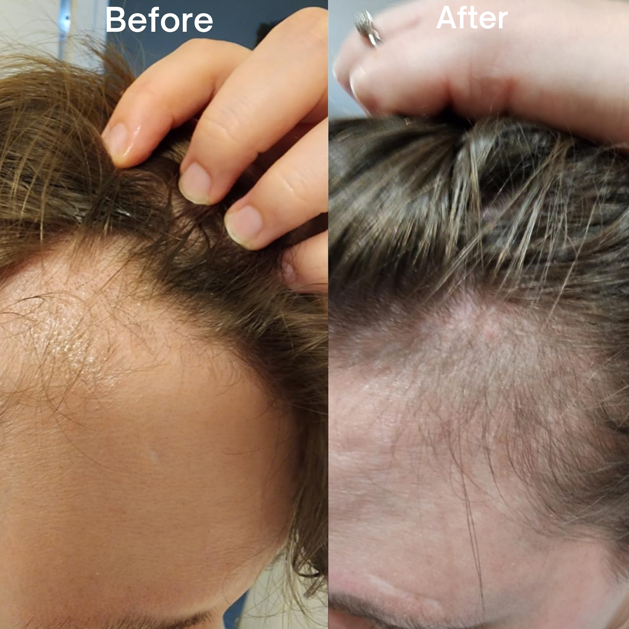 Flaevara™ Advanced Peptide Hair Growth Serum