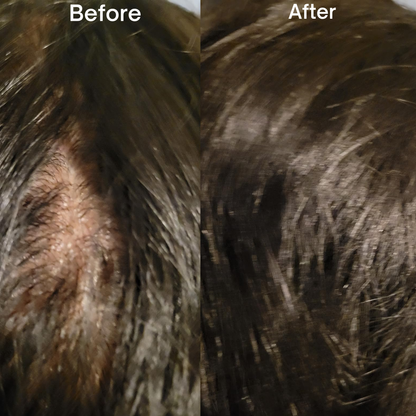 Flaevara™ Advanced Peptide Hair Growth Serum